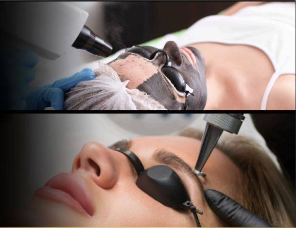 Faire et suivre Formation PACK CARBON PEEL & SPEED DETATOUAGE à Toulouse, Haute-Garonne 